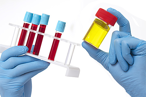 Blood lab and urine testing